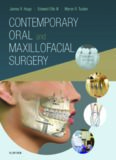 Contemporary Oral and Maxillofacial Surgery