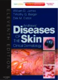 Andrews' Diseases of the Skin: Clinical Dermatology - Expert Consult - Online and Print (James, Andrew's Disease of the Skin), 11th Edition  